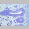 Intestino Delgado 19.jpg